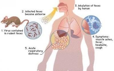 Illustration for Hantavirus Transmission and Symptoms (Rodent Virus)