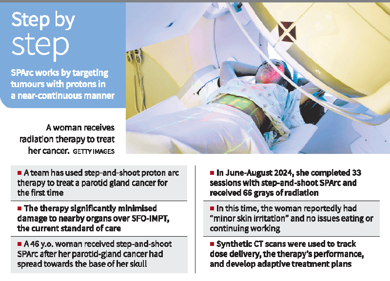 Illustration for SPArc Proton Arc Therapy (Proton Therapy)