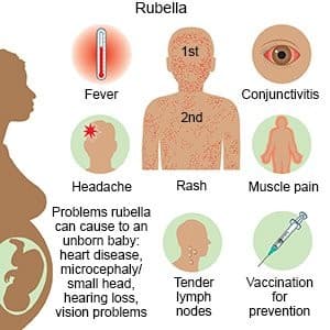 Illustration for Nepal Rubella-Free Status (Rubella Elimination)