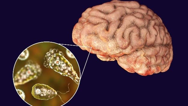 Illustration for Brain-Eating Amoeba Outbreak (Naegleria fowleri)