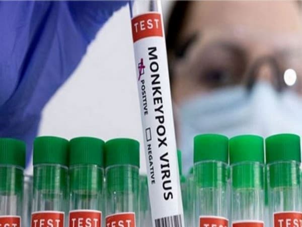 Illustration for Mpox Viral Zoonotic Disease (Viral Zoonosis)