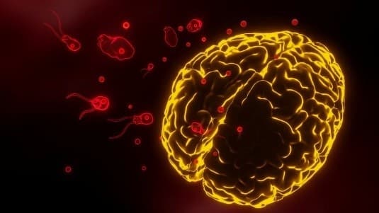 Illustration for Amoebic Meningoencephalitis Infection (Naegleria fowleri)