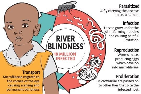 Illustration for Niger Eliminates River Blindness (Neglected Tropical Disease)