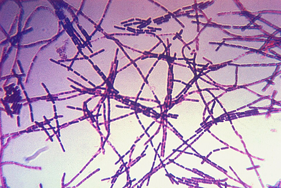 A Gram-stained smear under the microscope: long, straight, deep purple rod-shaped bacteria joined end to end into chains that criss-cross the whole field, each rod squared off at the ends, against a pale pink and cream background.