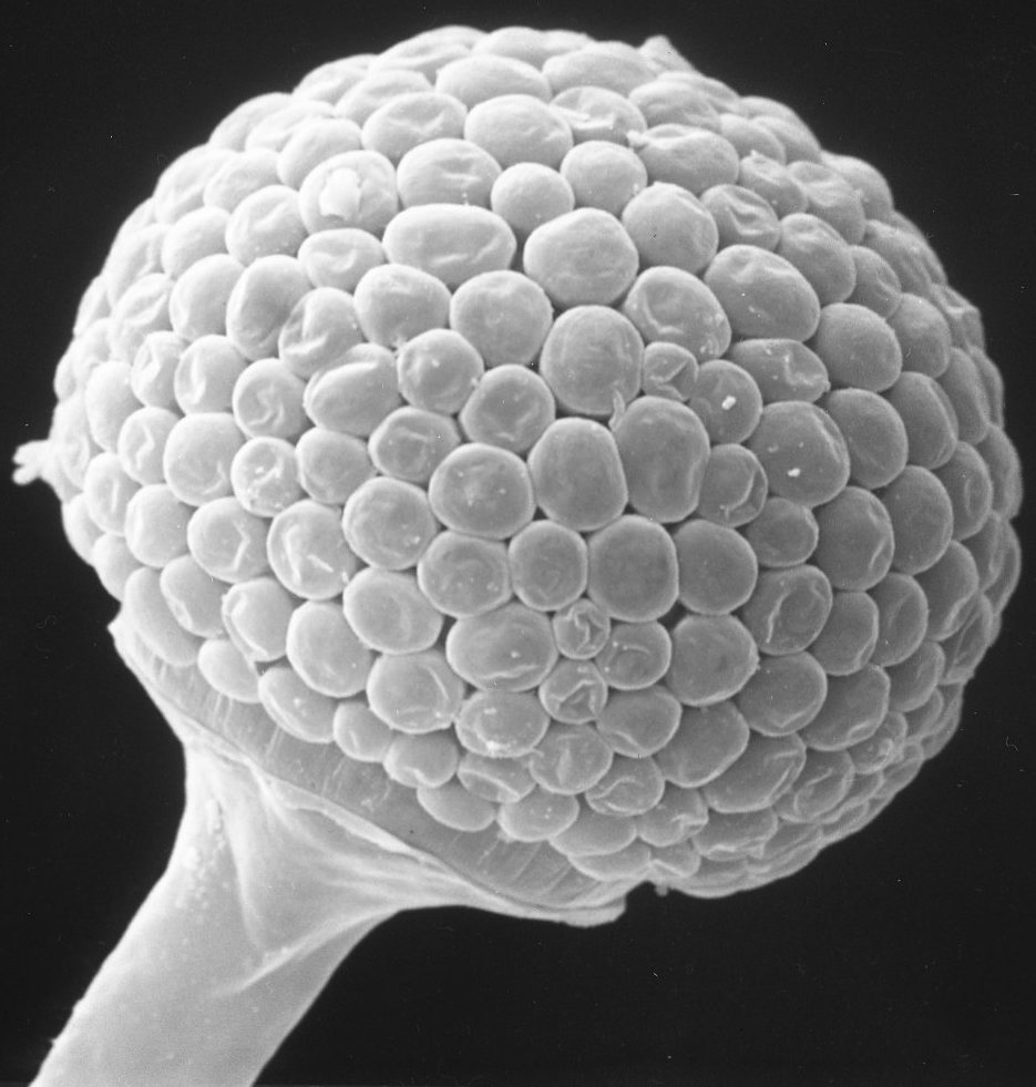 A greyscale scanning electron micrograph of a single Rhizopus sporangium — a globe densely paved with rounded spores, sitting on top of a smooth stalk-like sporangiophore against a black background