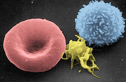 False-coloured scanning electron micrograph of three blood cells: a pink red blood cell with its characteristic central dimple, a spiky yellow platelet, and a rounded blue white blood cell