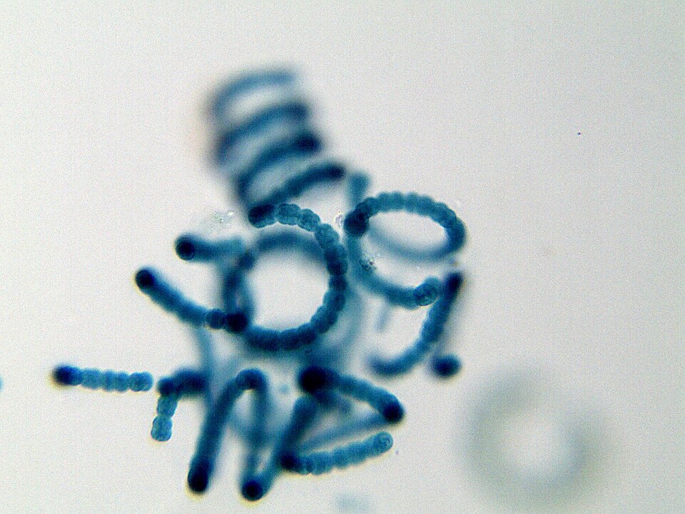 Light micrograph of coiled Anabaena filaments, chains of bead-like blue-stained cells with occasional larger cells along their length