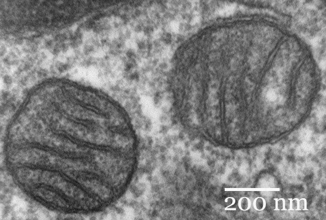 Transmission electron micrograph of two rounded mitochondria in a lung cell, each bounded by a double membrane with the inner membrane folded into cristae, with a 200 nm scale bar