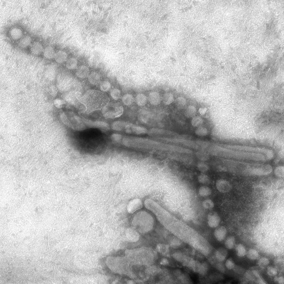 A greyscale transmission electron micrograph showing rod-shaped and spherical influenza virus particles studded with surface spikes.
