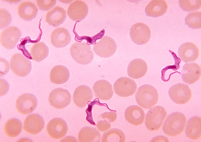 A stained blood smear under the microscope showing several slender, curved Trypanosoma parasites lying among round pink red blood cells.
