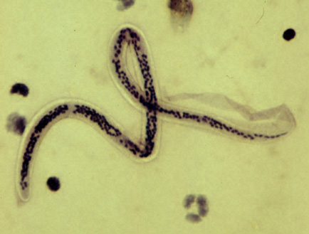 A microscope view of a stained blood smear showing a single long, looped microfilaria of Wuchereria bancrofti with a dark column of nuclei along its body and a clear sheath extending past its tapered tail.