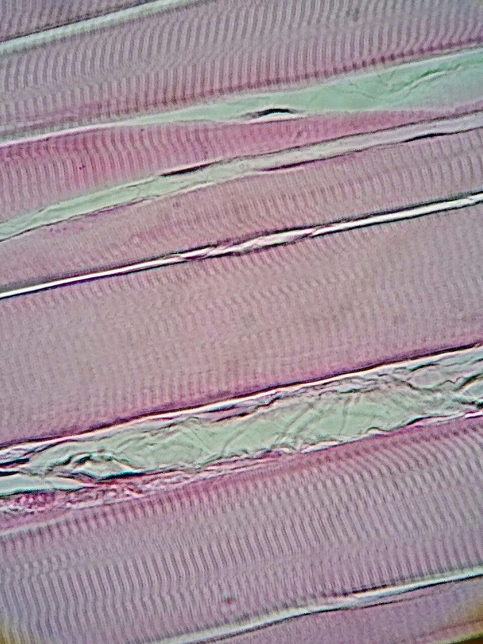 A light micrograph at 400x of stained skeletal muscle, showing long pink fibres running across the frame with fine repeating cross-striations.