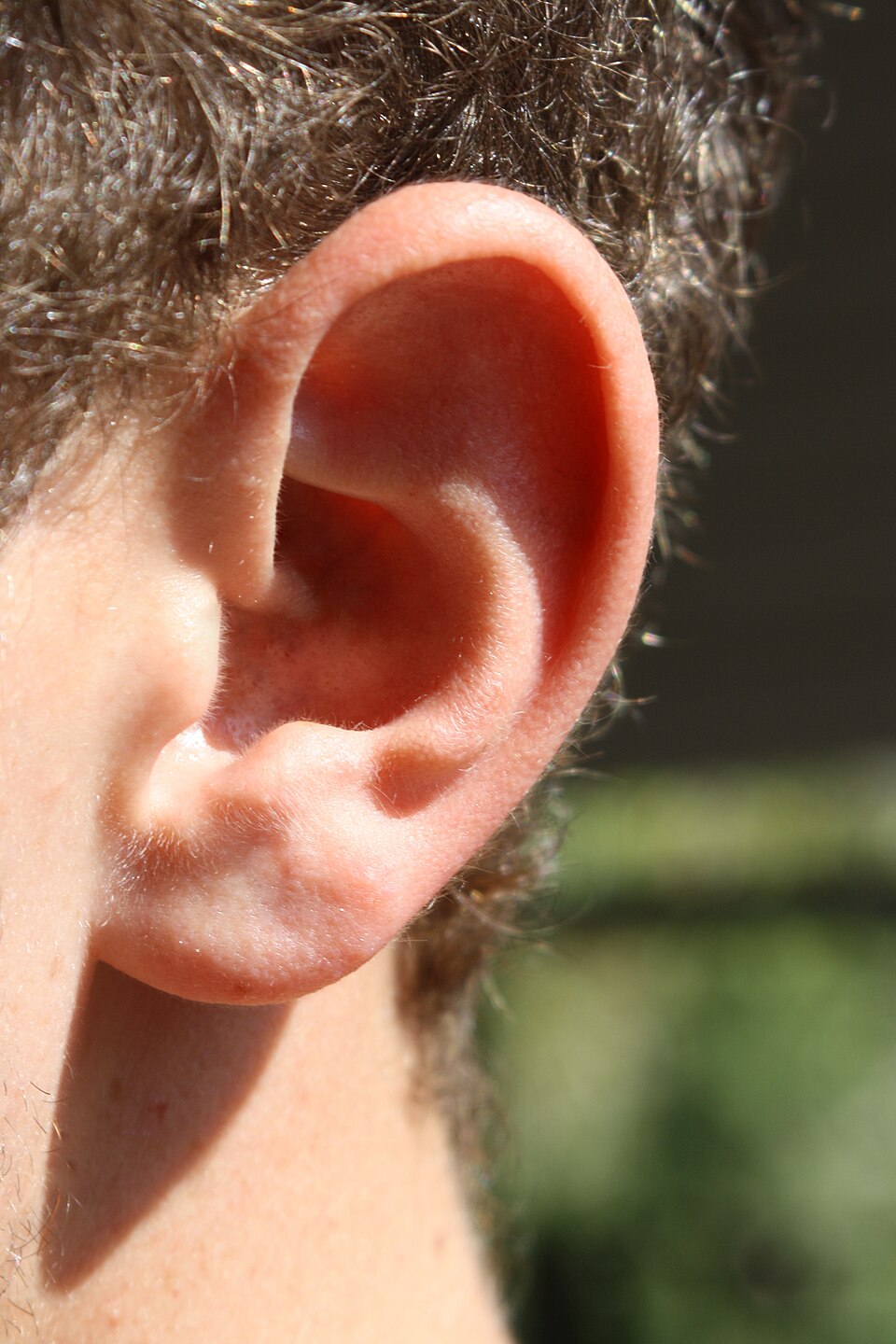 Close-up of the human outer ear (pinna), a site of springy elastic cartilage