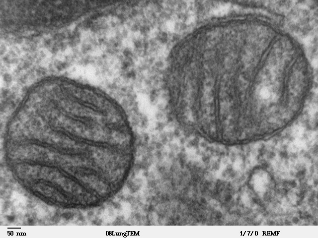 Transmission electron micrograph of two mitochondria showing the folded inner-membrane cristae and matrix