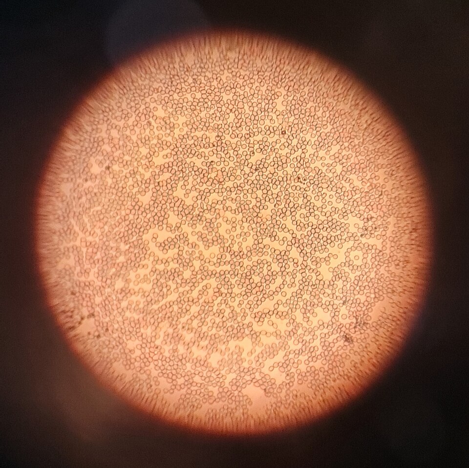 Human red blood cells seen as many small biconcave discs under a light microscope