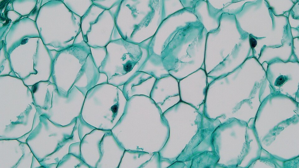 Stained light-microscope view of rounded, thin-walled plant parenchyma cells with intercellular spaces.