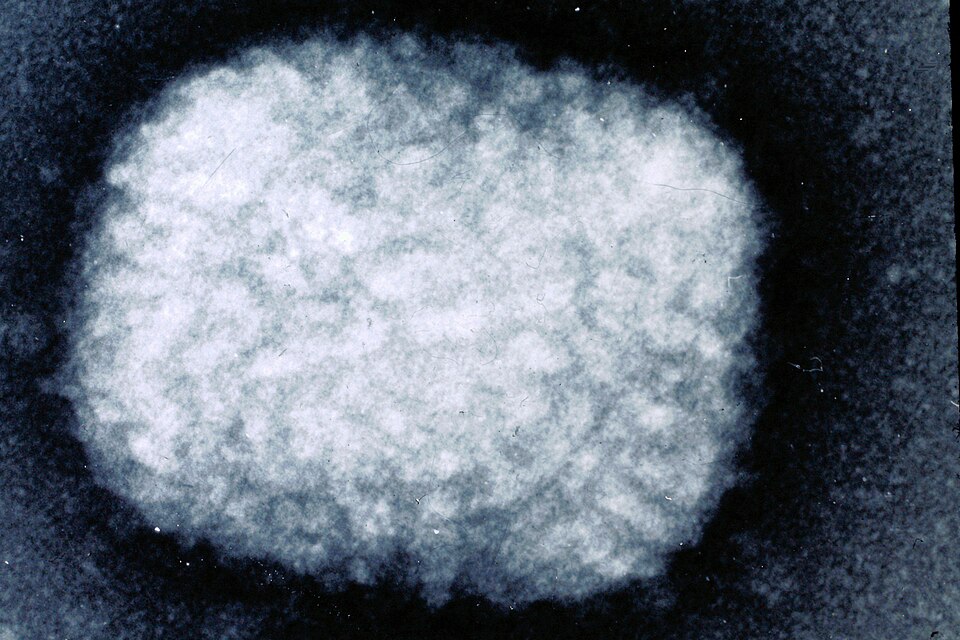 Transmission electron micrograph of a single brick-shaped variola (smallpox) poxvirus particle.