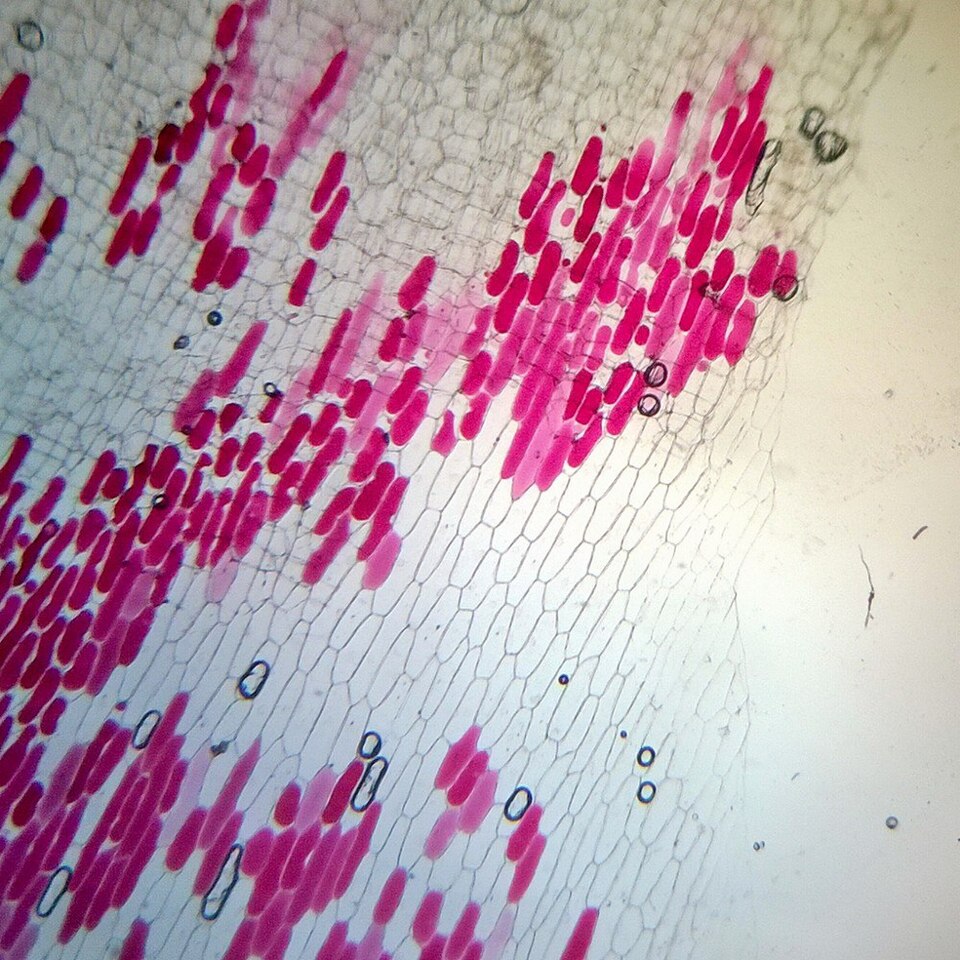 Light-microscope view of onion peel cells, where a mesh of thin cell-wall outlines divides the field into brick-shaped cells, many holding pink-stained contents.