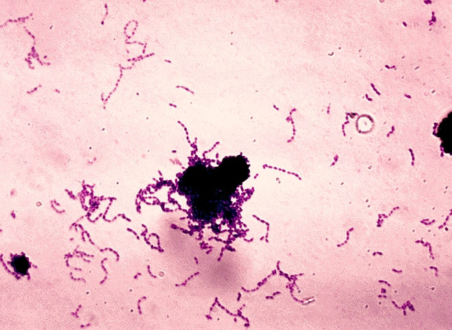 A stained micrograph of Streptococcus mutans, showing the bacterium's purple-stained round cells joined end to end in chains against a pink background.