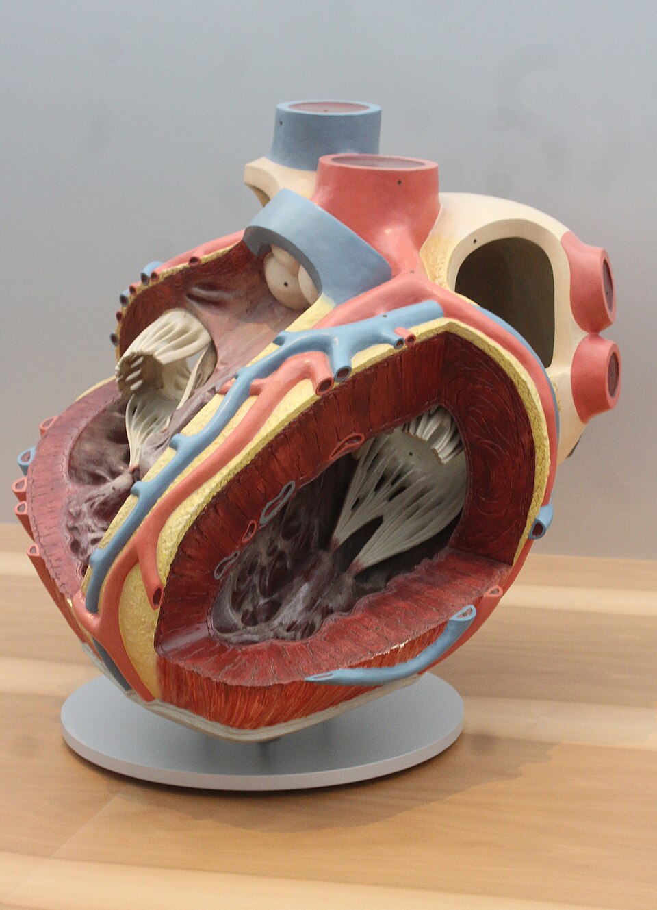 Colored anatomical model of the human heart showing chambers and the great vessels with arteries in red and veins in blue