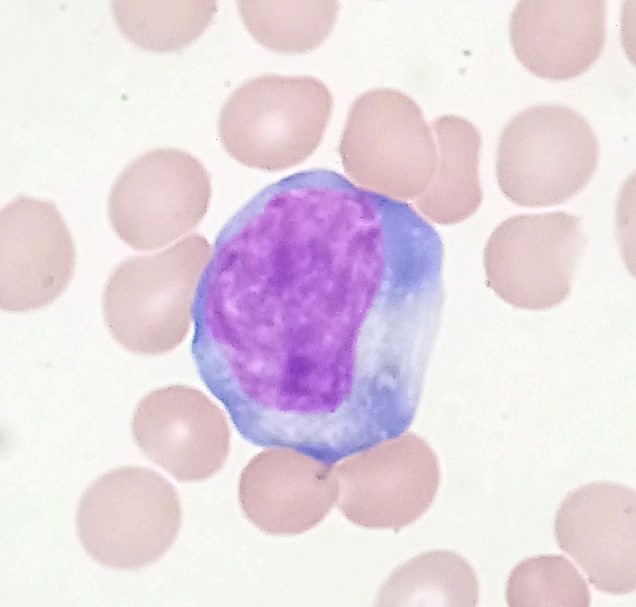 Light micrograph of a human lymphocyte with a large purple nucleus among red blood cells in a stained blood smear