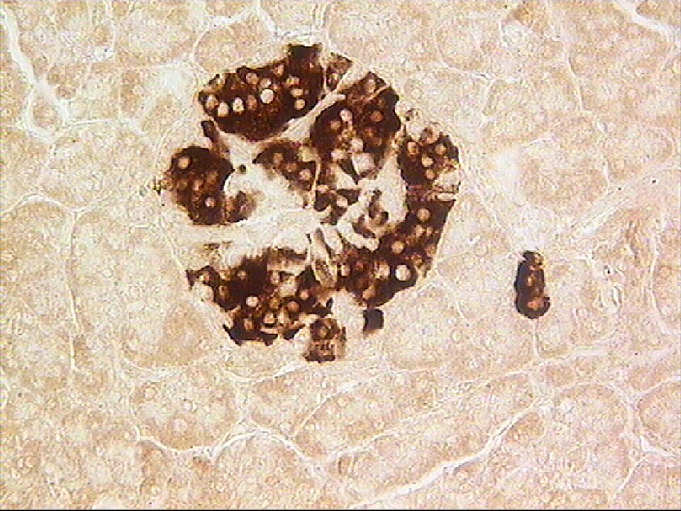 Light micrograph of a stained pancreas section: a rounded cluster of dark brown-stained hormone-producing cells, an islet of Langerhans, sits embedded within the paler surrounding glandular tissue