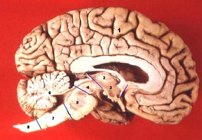 Midsagittal section of a real human brain specimen showing the folded cerebrum, the striated cerebellum at lower left, and the brainstem, with numbered labels
