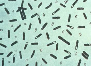 A stained photomicrograph showing many dark rod-shaped bacteria and pale oval spores against a light blue-green background.