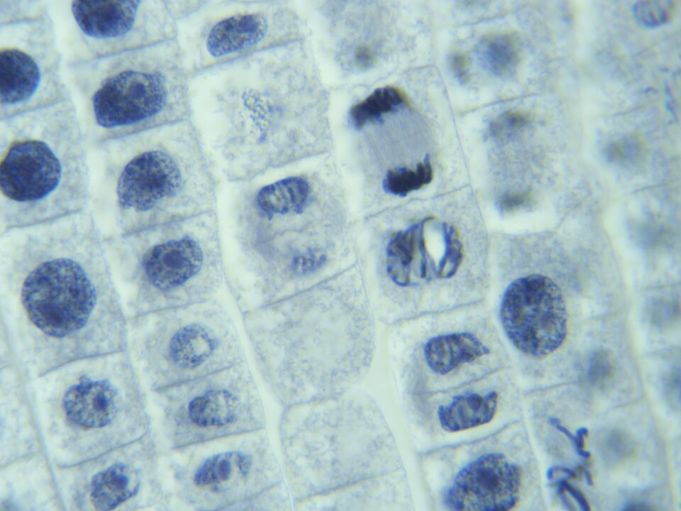 A photomicrograph of a stained onion root tip: rows of rectangular plant cells outlined by pale walls, most holding a round speckled blue nucleus, while several cells instead show dark blue condensed chromosomes lined up across the middle or pulled apart towards opposite ends
