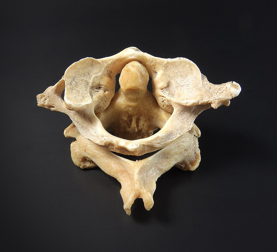 The articulated human atlas and axis vertebrae photographed from above on a black background, with the peg-like dens of the axis standing upright inside the bony ring of the atlas